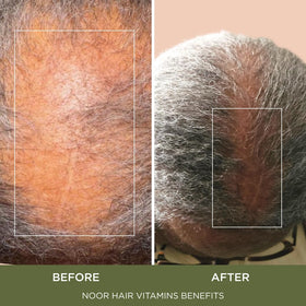 NOOR HAIR lifestyle photo of woman taking supplement showing convenient use