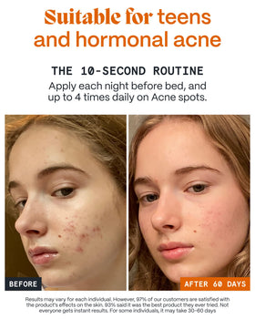 Norse Organics sea buckthorn and rosehip botanicals showcasing active ingredients