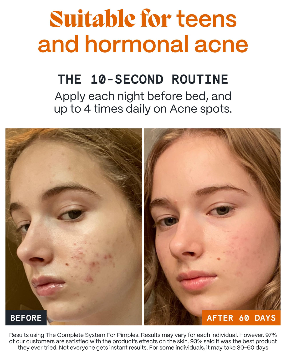 Norse Organics balm applied to cheek during nighttime routine for soothing
