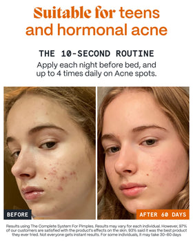 Norse Organics balm applied to cheek during nighttime routine for soothing