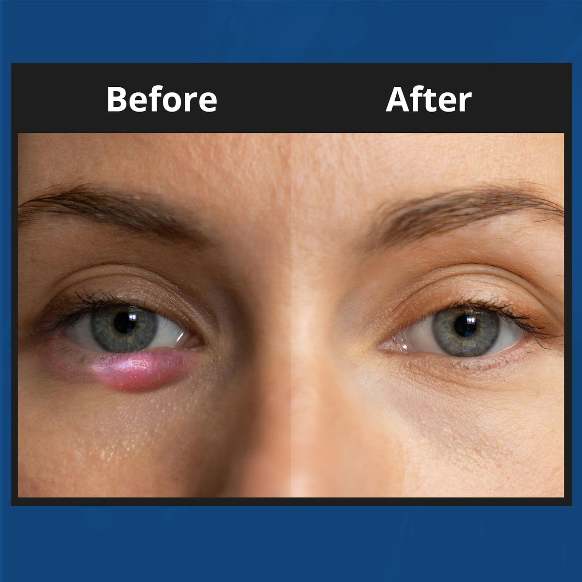 NOVEHA foam on finger ready for application to lashes for safe cleansing