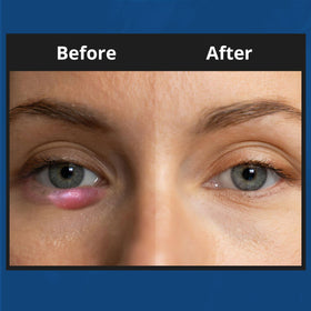 NOVEHA foam on finger ready for application to lashes for safe cleansing