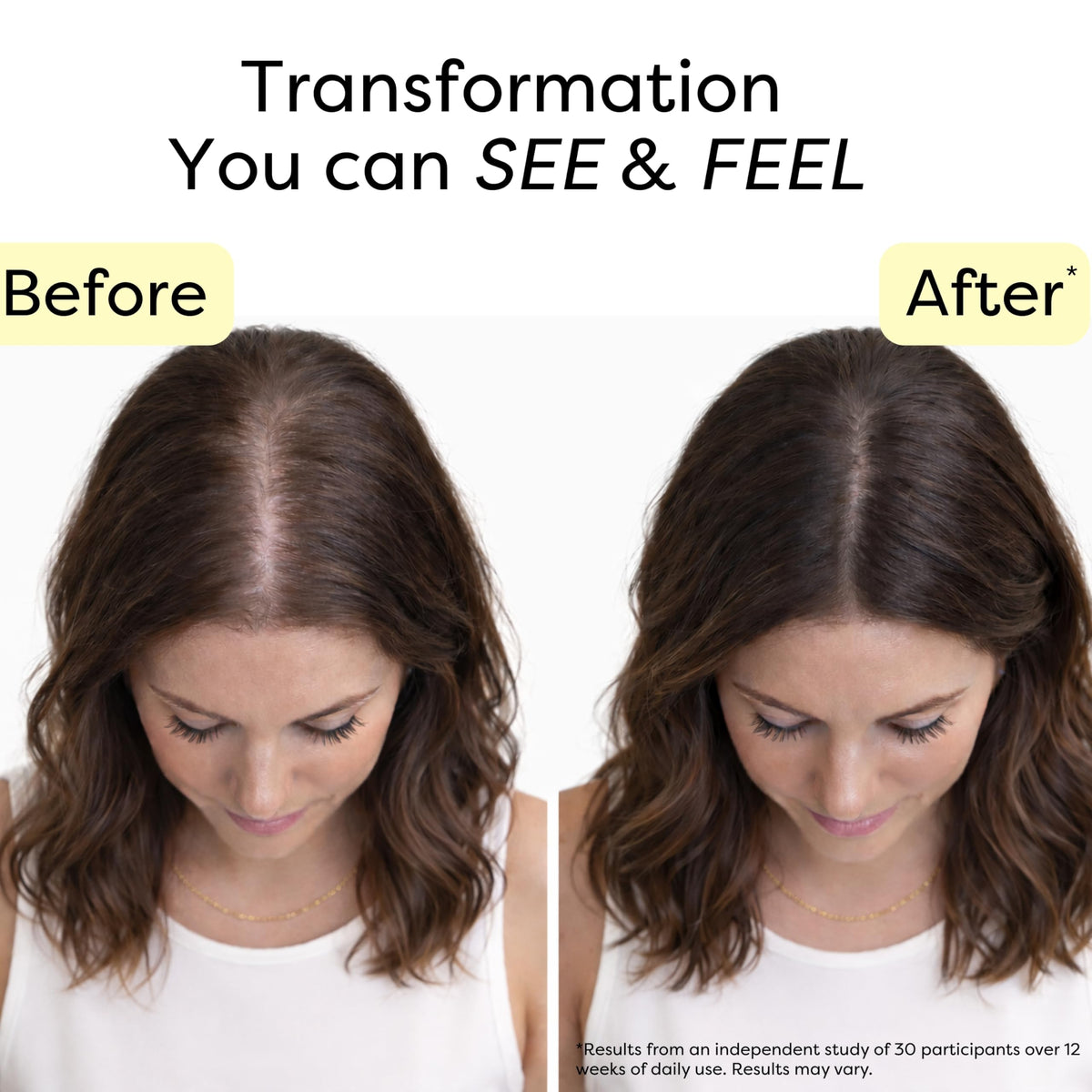 Novokind rosemary and turmeric visually representing calming scalp benefits