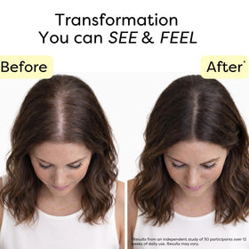 Novokind rosemary and turmeric visually representing calming scalp benefits