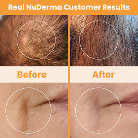 Pure Daily Care NuDerma styled on bathroom vanity to illustrate everyday at-home skincare routine
