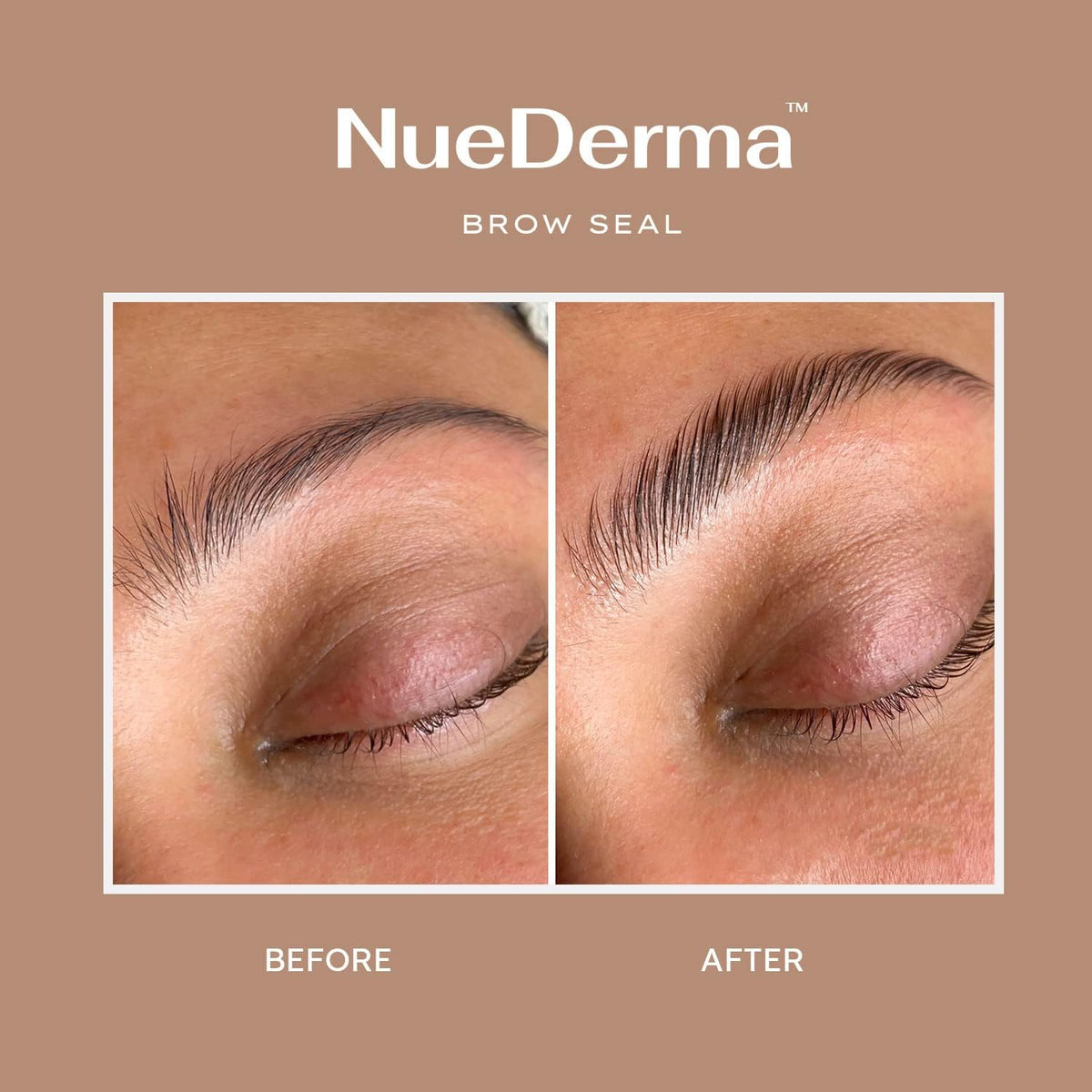 NueDerma before and after brows demonstrating lift and fuller appearance