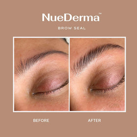 NueDerma before and after brows demonstrating lift and fuller appearance