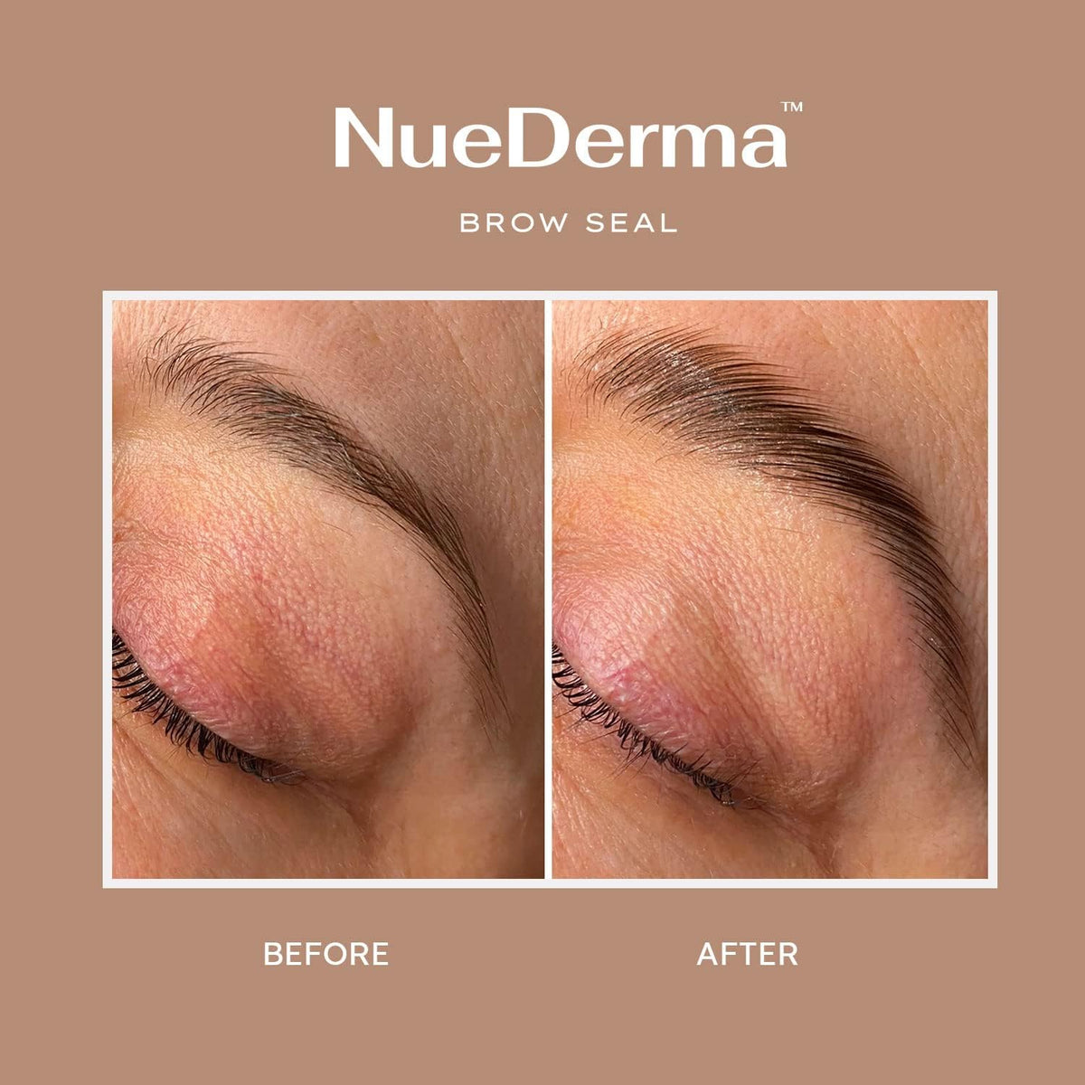 NueDerma size comparison with 1 oz jar illustrating compact travel-friendly benefit