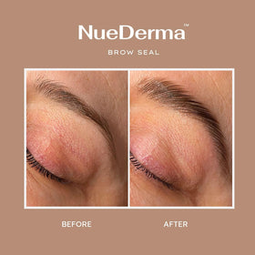 NueDerma size comparison with 1 oz jar illustrating compact travel-friendly benefit