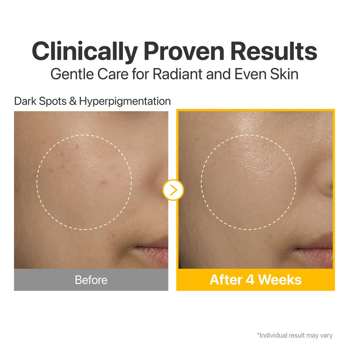 numbuzin serum on hand demonstrating fast-absorbing texture