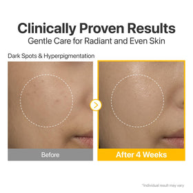 numbuzin serum on hand demonstrating fast-absorbing texture