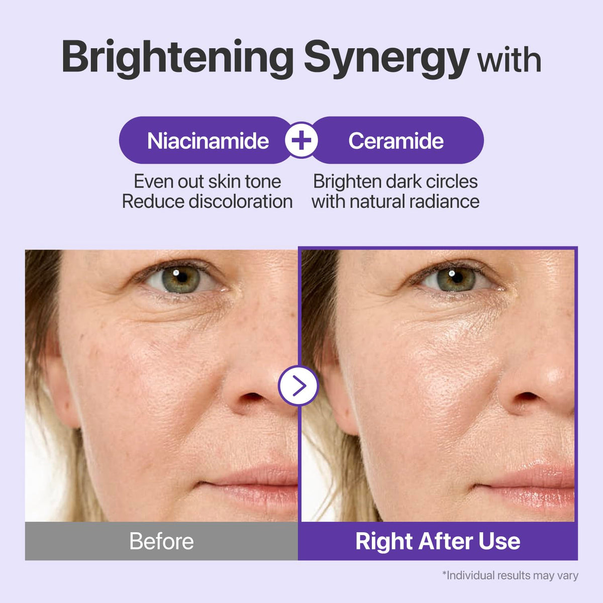 numbuzin used on forehead and smile lines showing targeted full-face benefit