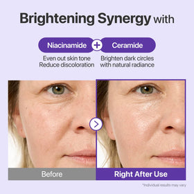 numbuzin used on forehead and smile lines showing targeted full-face benefit