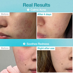 numbuzin sheet texture close-up highlighting soft fiber and serum retention