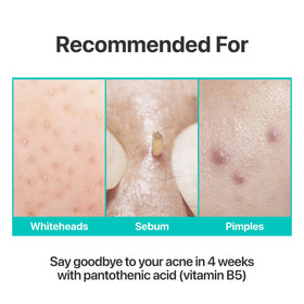 numbuzin applied as sleeping pack on cheek for overnight calm