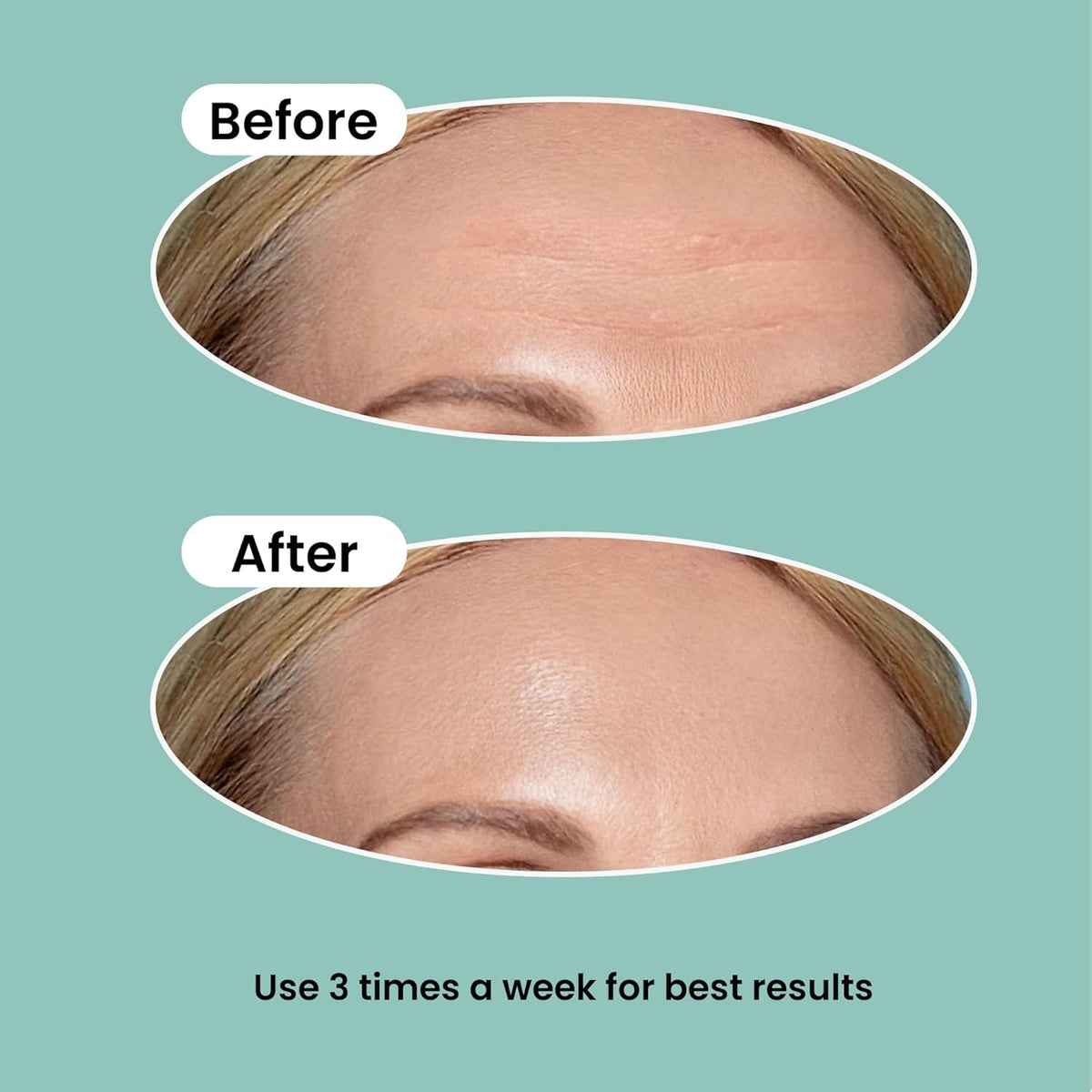 NURIVE patch held in hand to show large size and coverage for forehead lines
