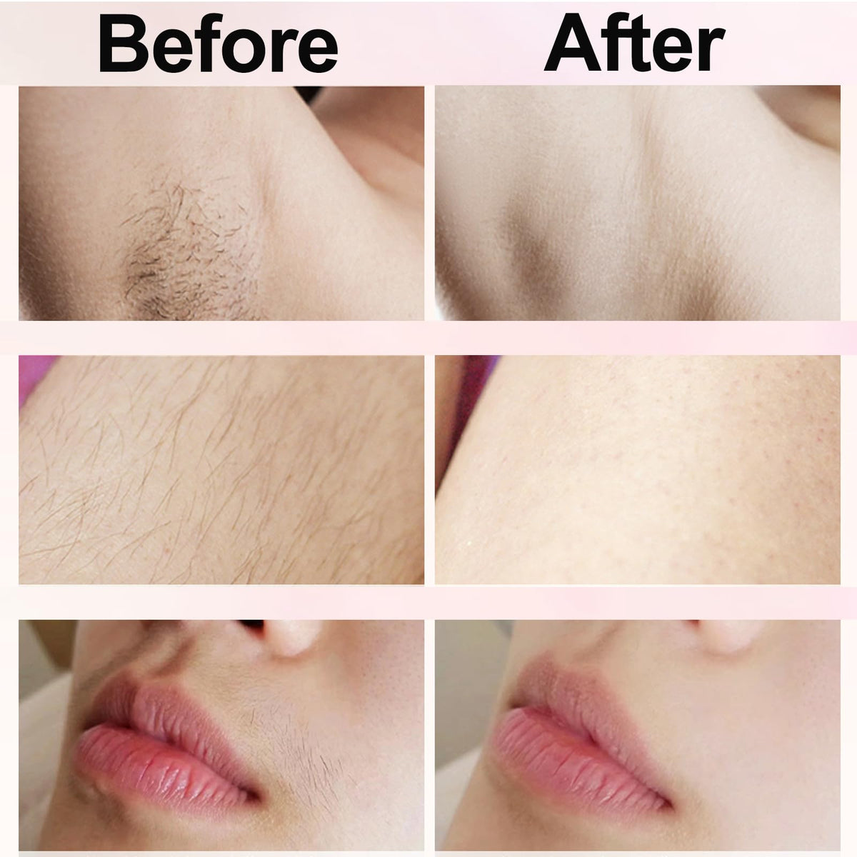NURSETEK in-use shaving legs demonstrating quick, even hair removal