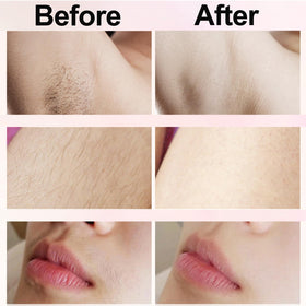 NURSETEK in-use shaving legs demonstrating quick, even hair removal