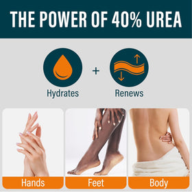 NUVADERMIS tube cap and ingredients label highlighting active urea and salicylic acid details
