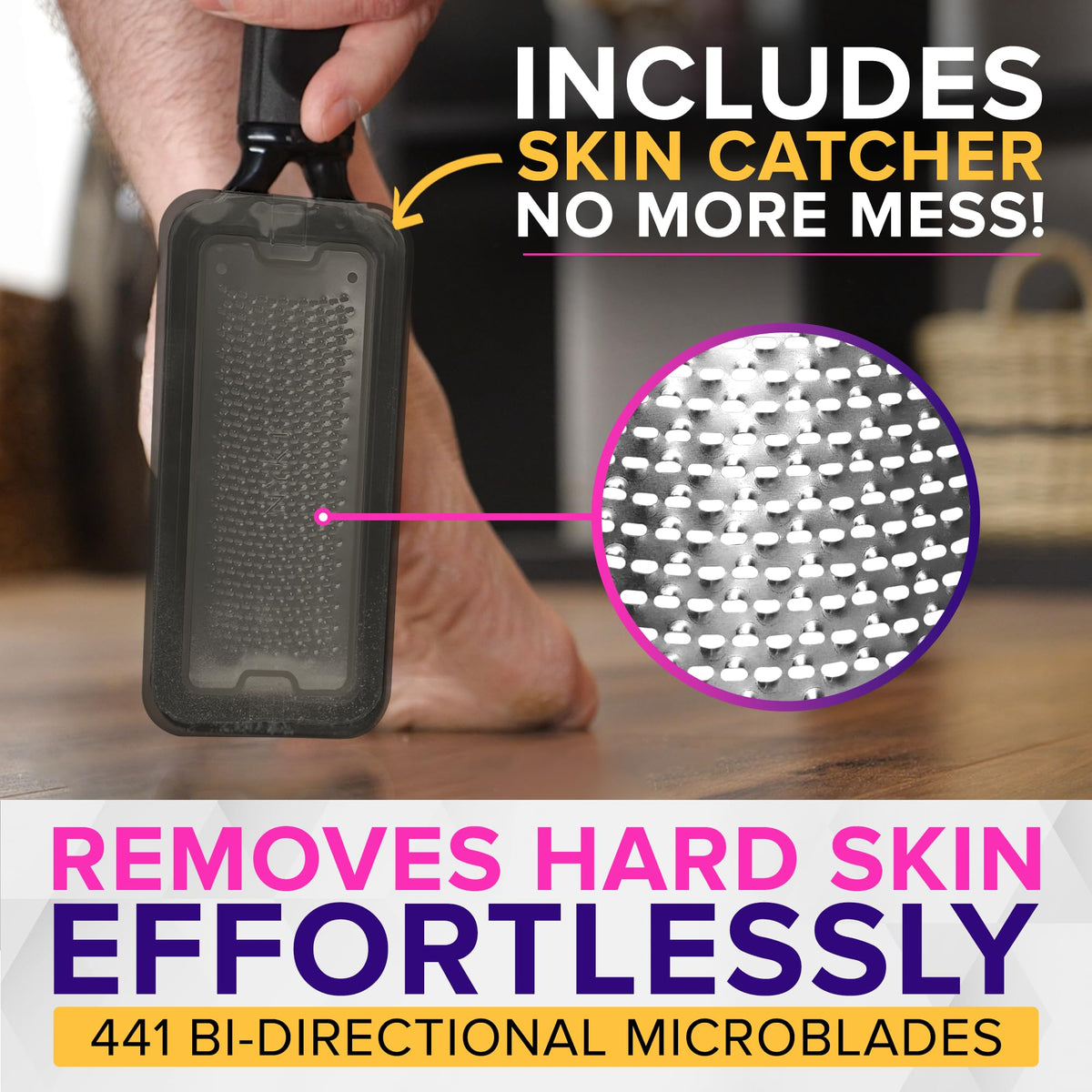 NYK1 skin catcher open to reveal trapped dead skin and simplified mess-free cleanup