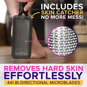 NYK1 skin catcher open to reveal trapped dead skin and simplified mess-free cleanup