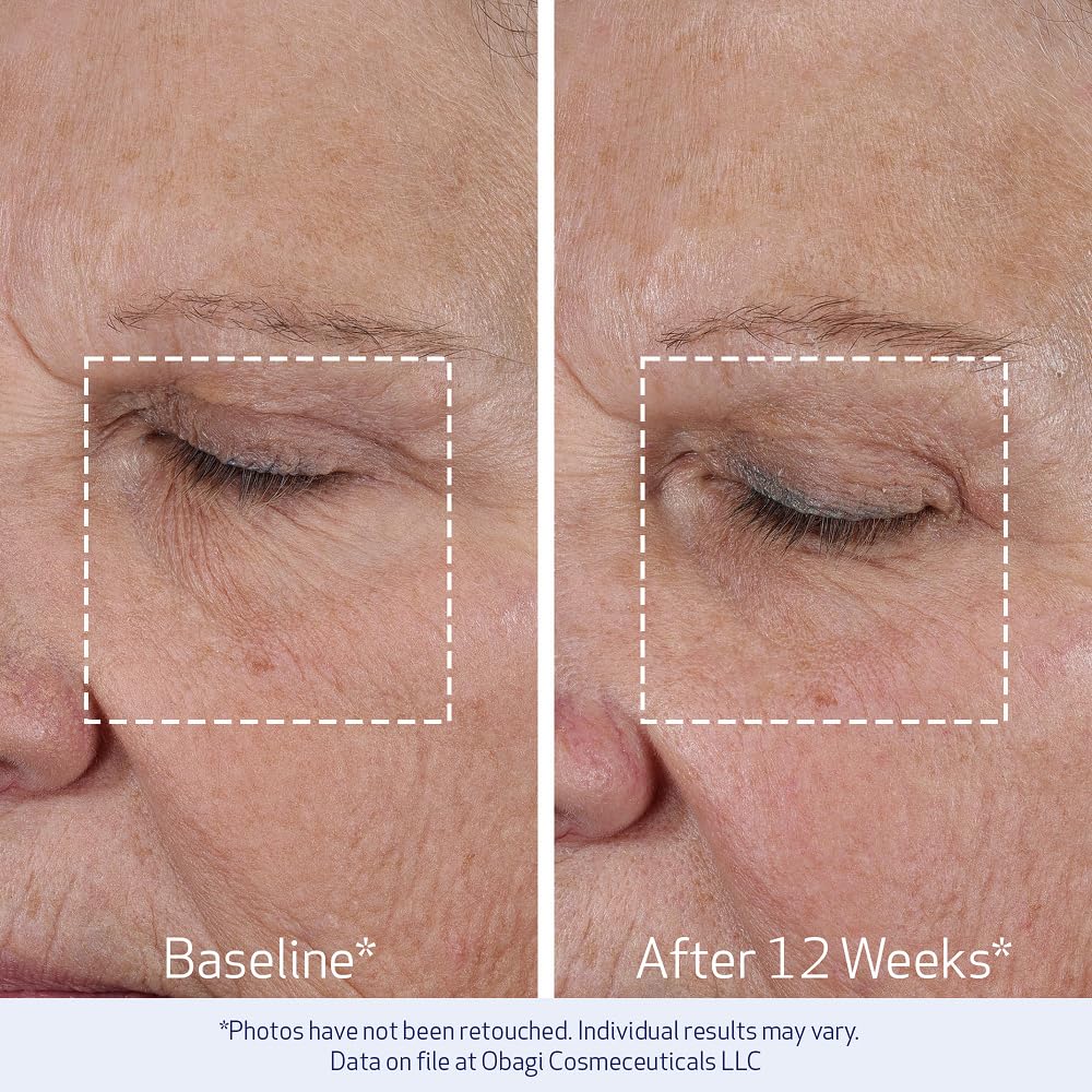 Obagi Medical application on cheek demonstrating lifting motion and visible smoothing