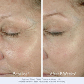 Obagi Medical visual of bi-mineral complex ingredient for improved elasticity