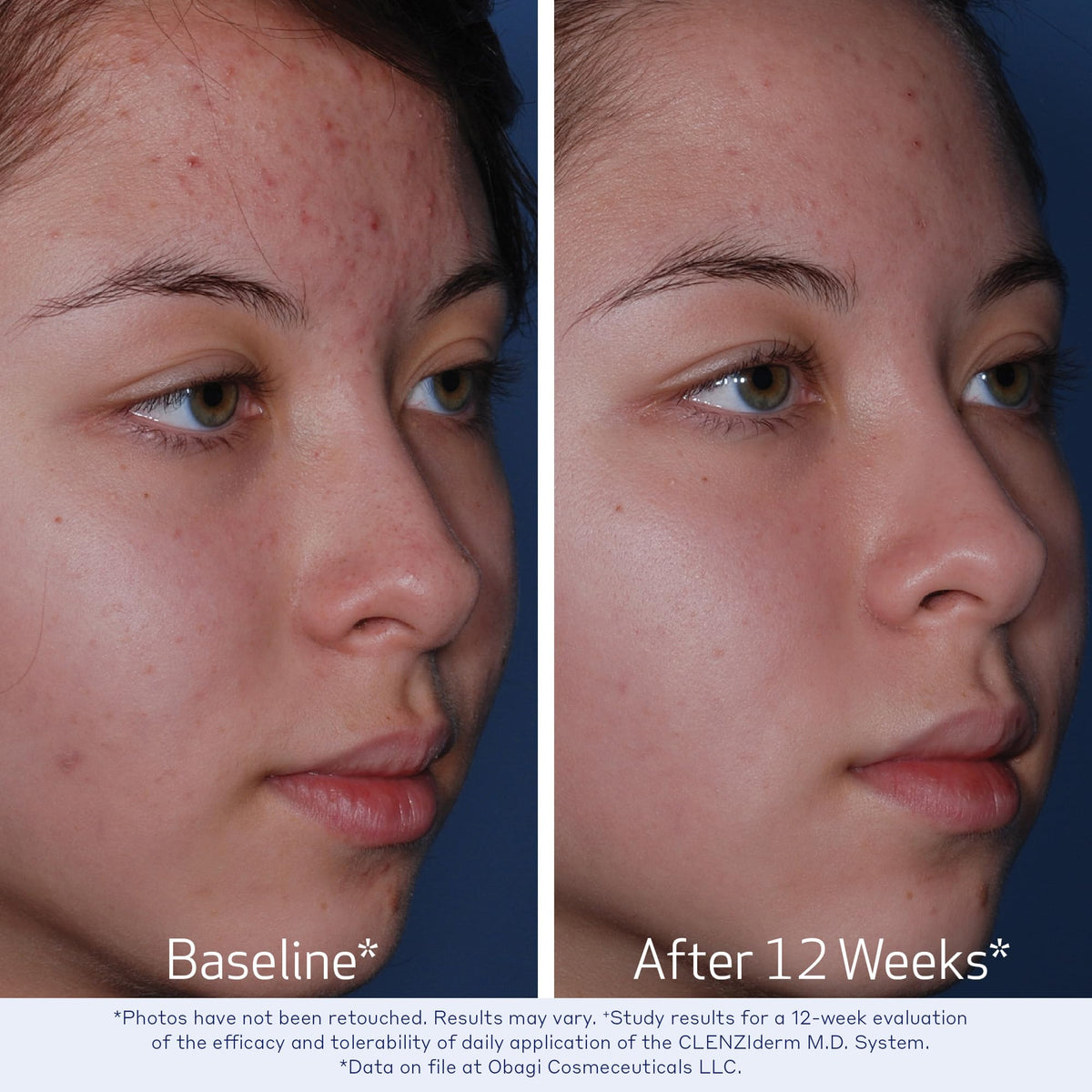 Obagi Medical clear liquid texture close-up demonstrating lightweight absorption