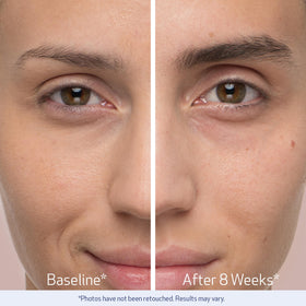 Obagi Medical applying serum to eyebrow showing correct use and cosmetic improvement