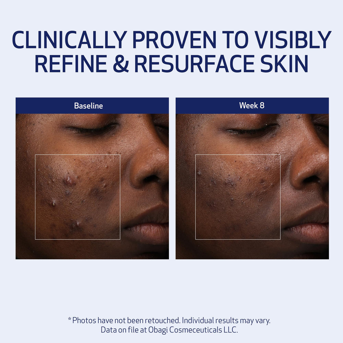 Visual of key ingredients next to jar highlighting Obagi Medical gentle exfoliation