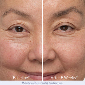 Obagi Nu-Cil serum applied to sparse brow area to promote fuller-looking brows