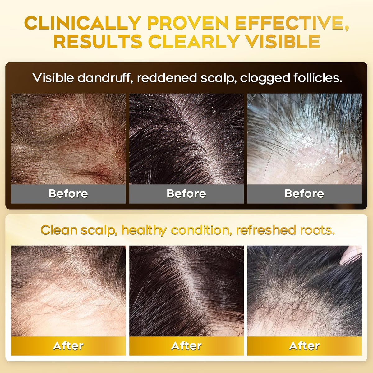 oely label ingredients close-up, shows dual antifungal actives and gentle base
