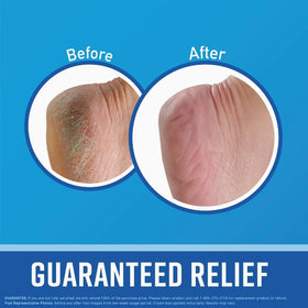 O'Keeffe's texture close-up illustrating creamy consistency and fast absorption benefit