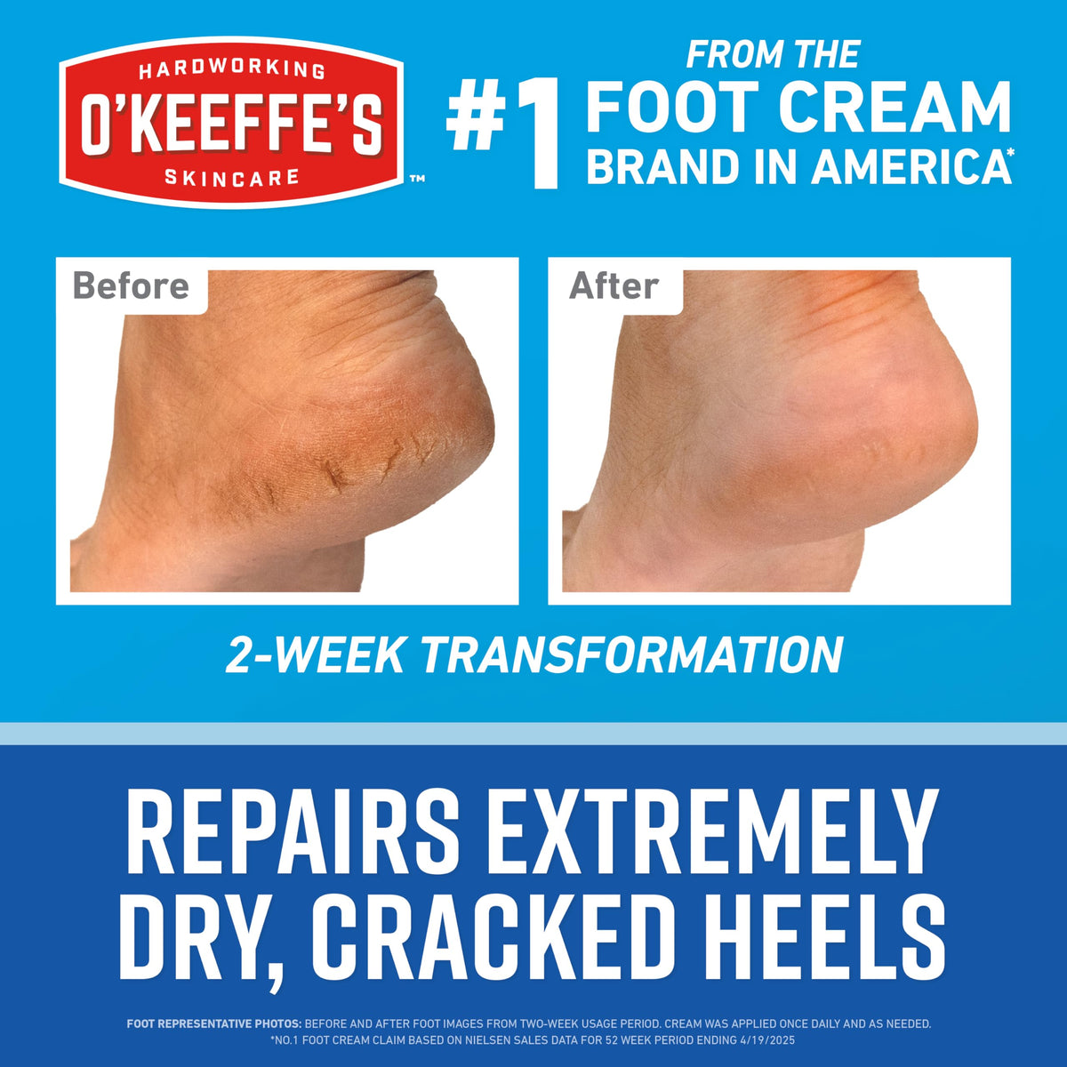 O'Keeffe's foot sleeve worn on foot demonstrating enhanced product absorption