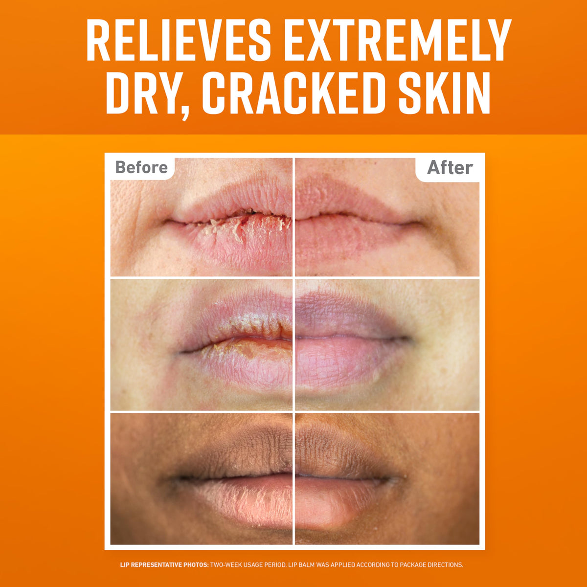 O'Keeffe's three lip repair sticks lined up highlighting variety and convenience
