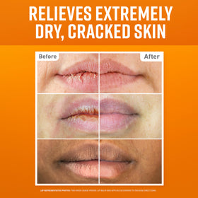 O'Keeffe's three lip repair sticks lined up highlighting variety and convenience