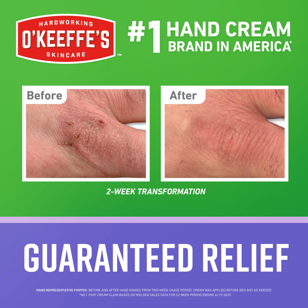 O'Keeffe's back label with directions and hypoallergenic information for users