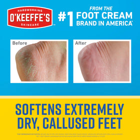O'Keeffe's cream texture close-up showing rich formula for softening skin