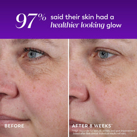 Olay label highlighting lactic acid for gentle exfoliation