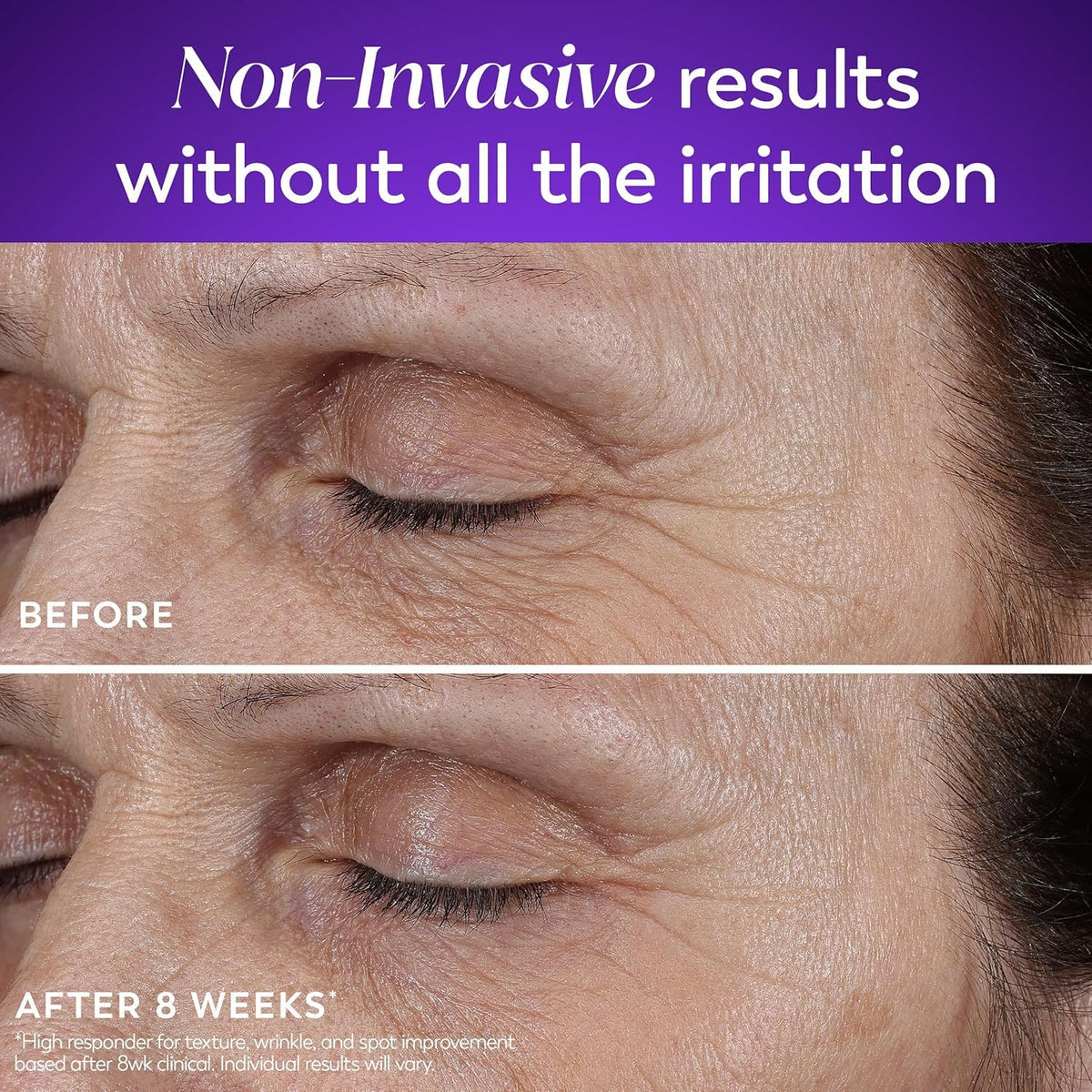 Olay being applied to cheek illustrating even coverage and smoothing