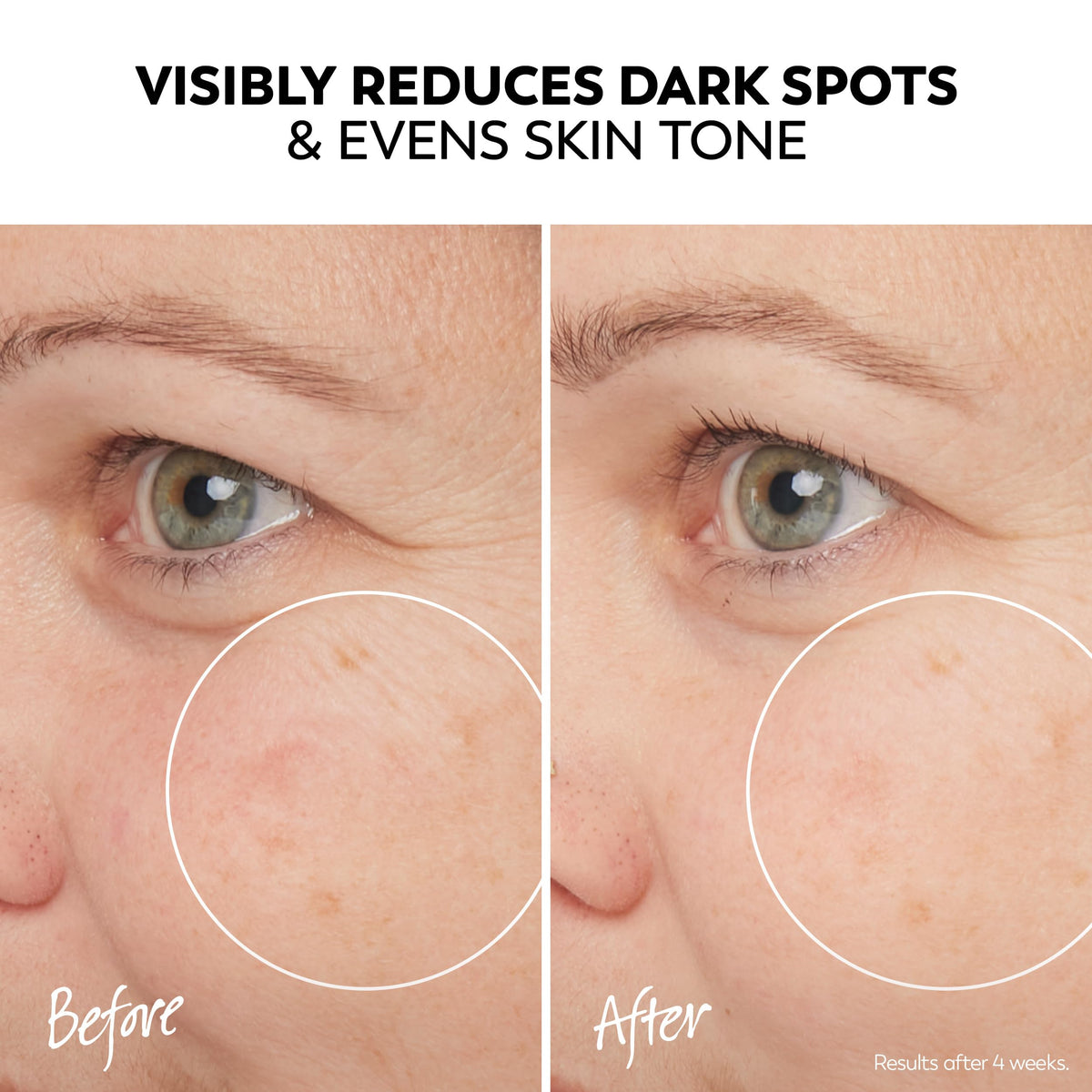 Olay Pro-X drop of serum on hand, precise application and targeted treatment benefit