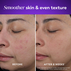 Olay retinol open jar top view highlighting smooth cream consistency