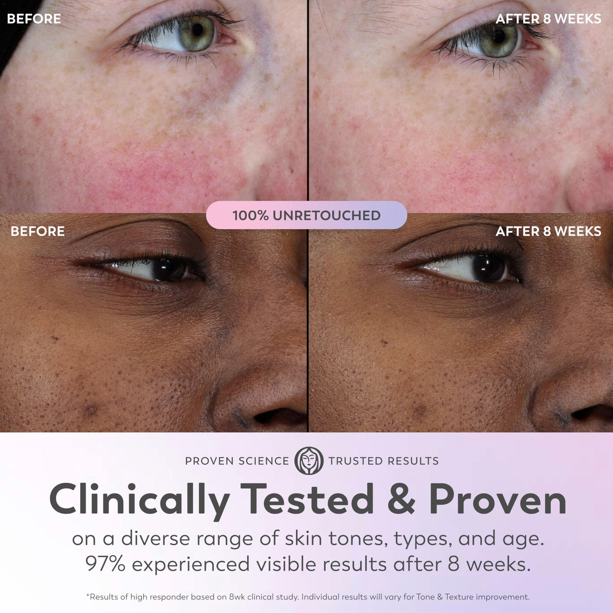 Hand applying Olay Super Serum to skin demonstrating easy spreadability benefit