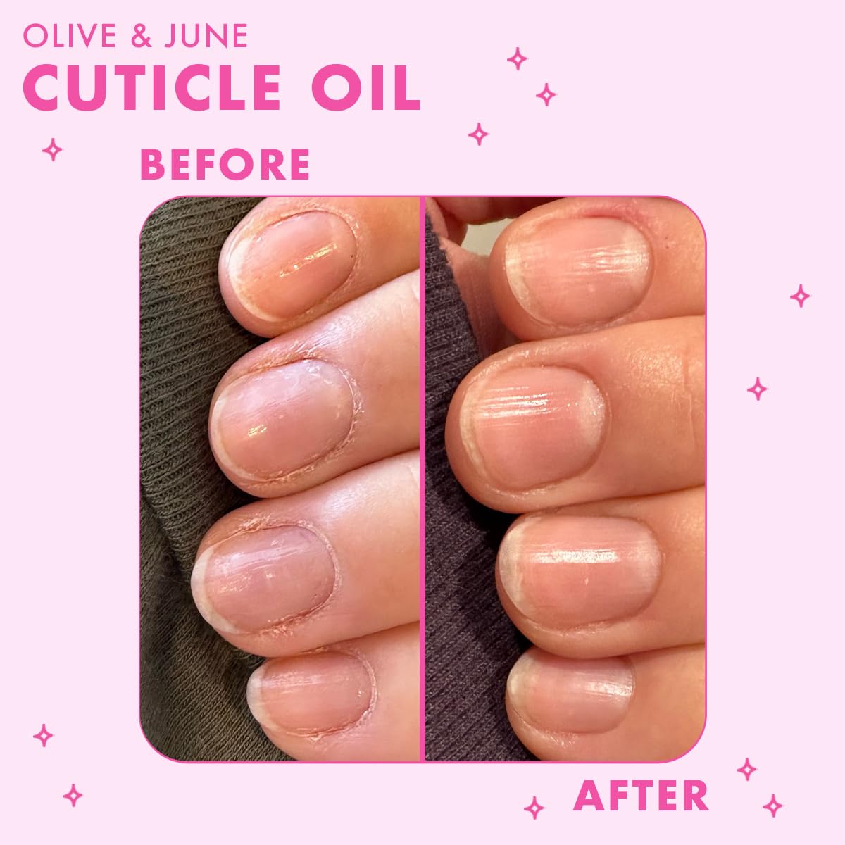 Olive & June being applied around fingernails for targeted hydration