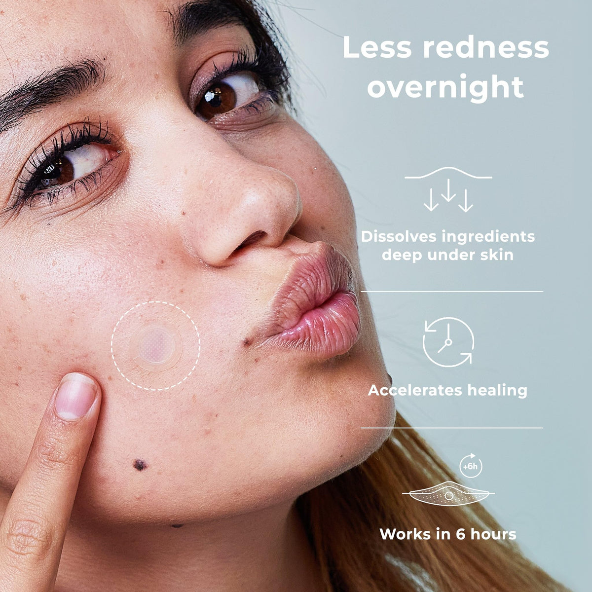 OMMA microdart macro texture revealing dissolving microcrystals for deeper delivery under skin