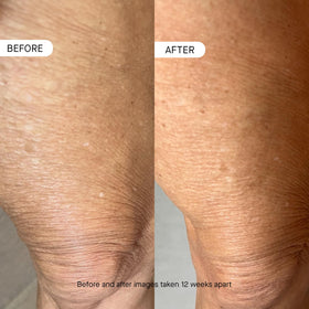 oneskin applying lotion on arm demonstrating improved skin comfort