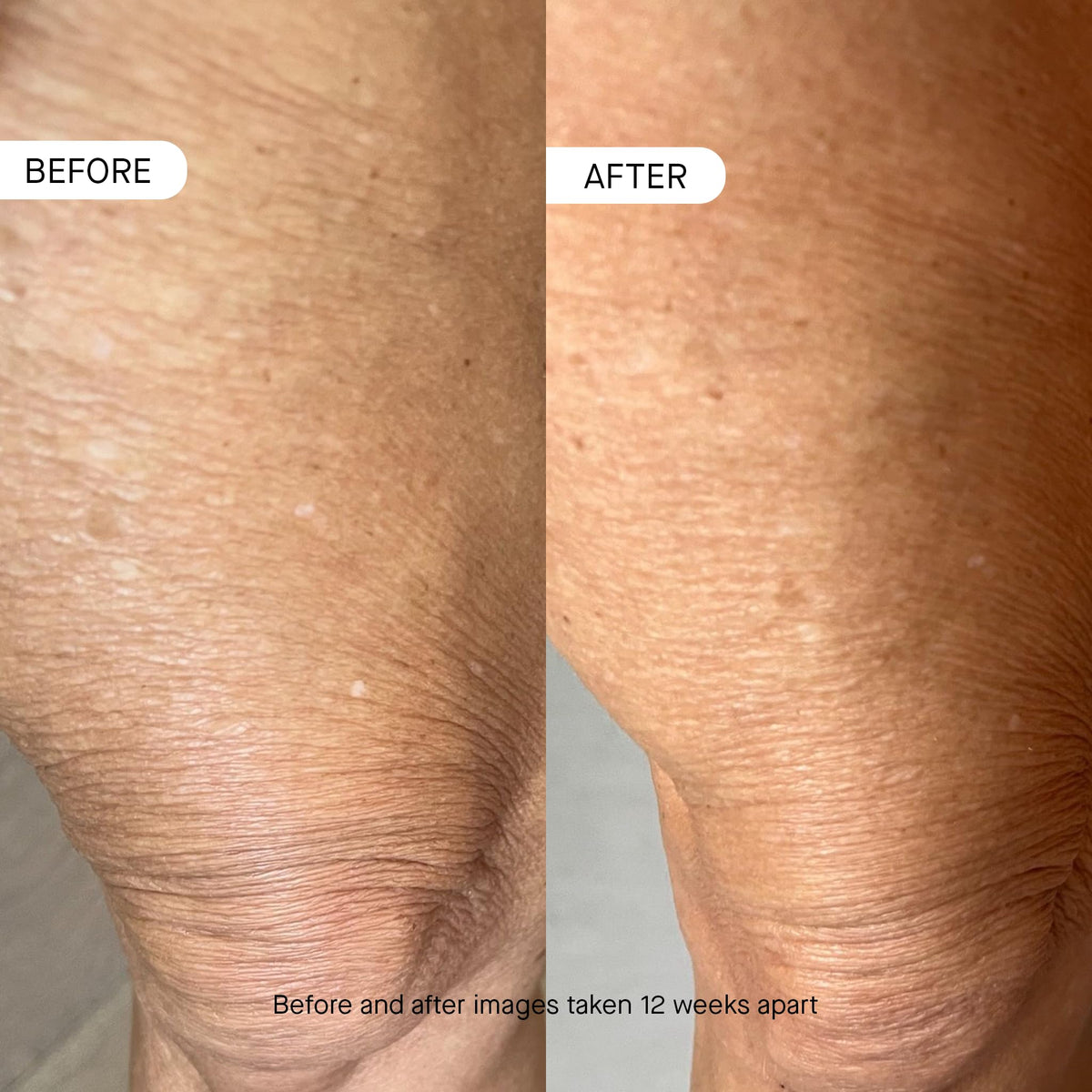 oneskin BODY OS-01 cream texture close-up displaying lightweight, fast-absorbing consistency