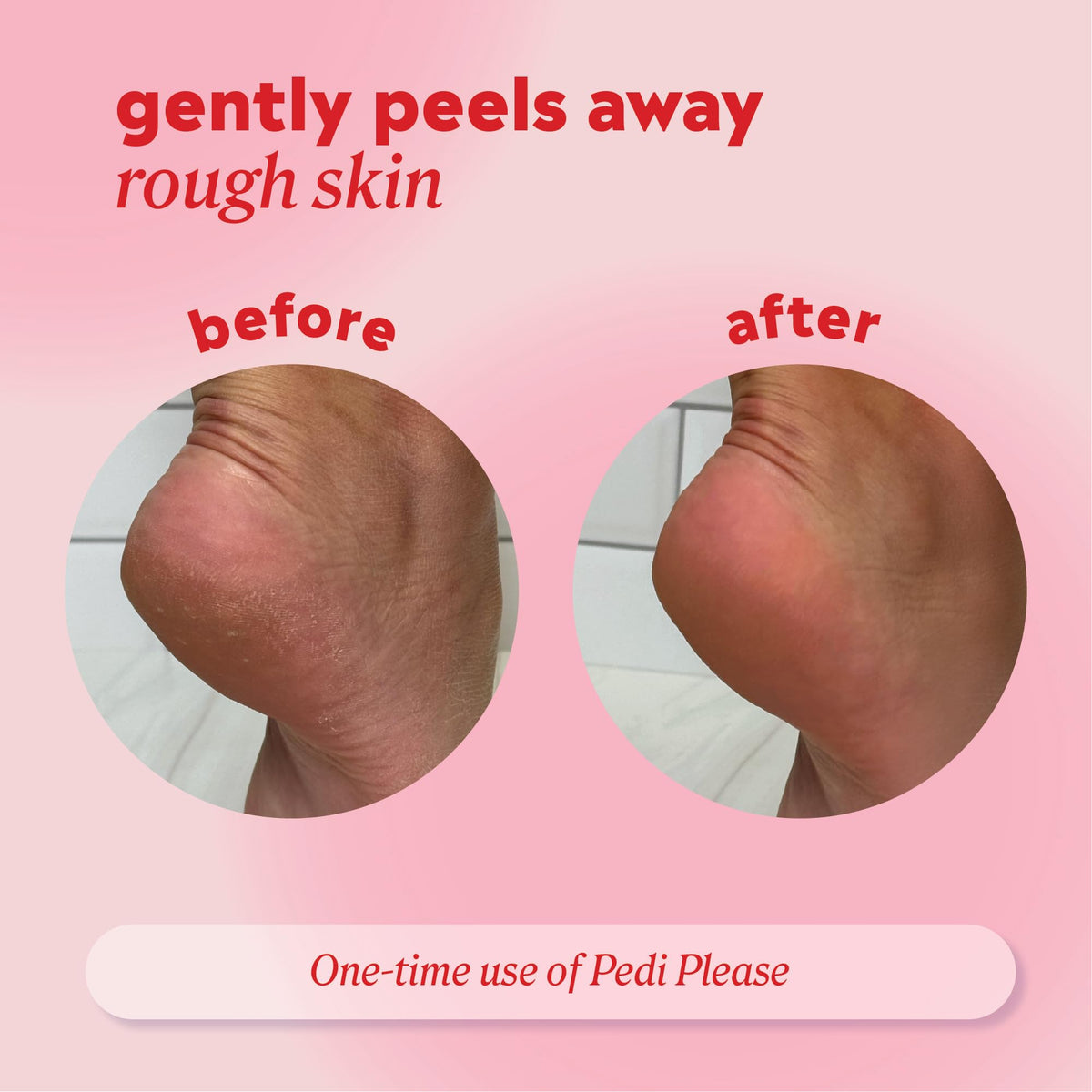 Onyx Professional built-in scrubber bristles detail showing physical exfoliation benefit