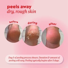 Onyx Professional soak step with feet in bowl showing preparation benefit