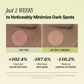OOZNARY ingredient label showing key actives and gentle formulation benefit